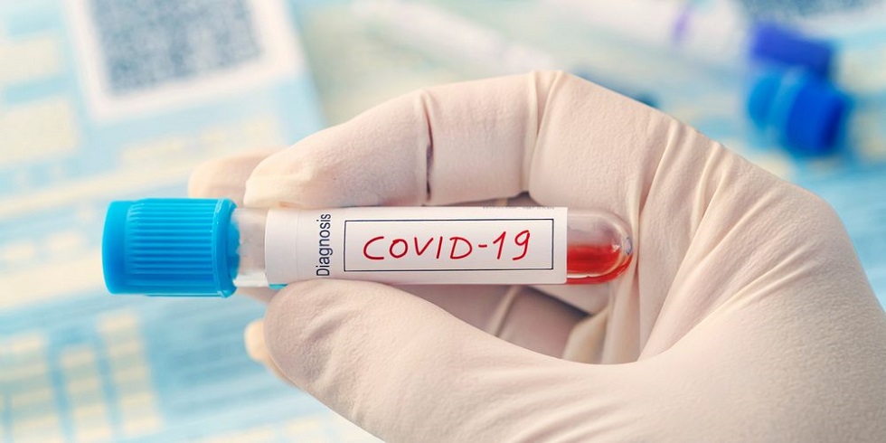 Қазақстанда өткен тәулікте 75 адамның коронавирус індетімен ауырғаны белгілі болды