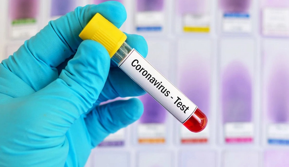 Больной целитель заразил 27 человек коронавирусом