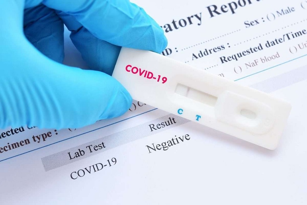 Пандемия: в Германии не хватает тестов на COVID-19 