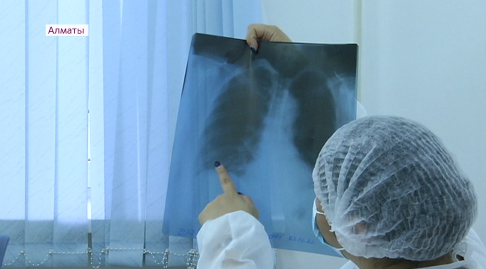 Алматыда туберкулезбен сырқаттану деңгейі 25%-ға төмендеді