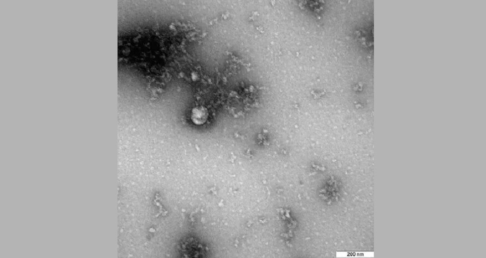 Первое фото британского штамма коронавируса показали ученые из России