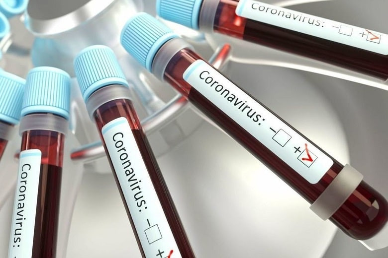 Қазақстандағы коронавирус: өткен тәулікте 1370 адамның ауырғаны белгілі болды
