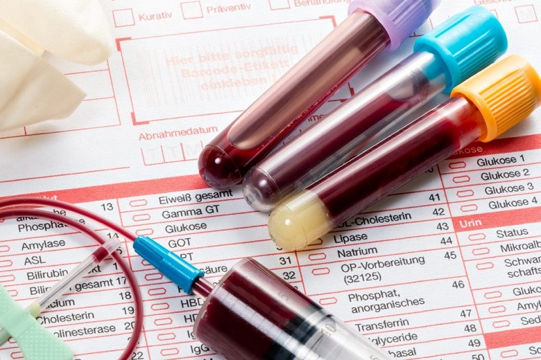 Врач опроверг популярное заблуждение о подготовке к анализу крови