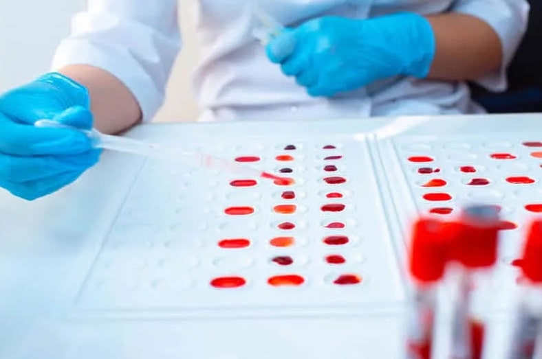 Ученые назвали самую уязвимую перед COVID-19 группу крови