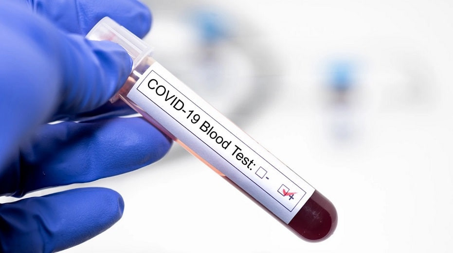 Қазақстандағы коронавирус: кейінгі тәулікте 1082 адамнан індет анықталды