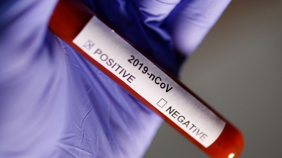 Қазақстандағы коронавирус: өткен тәулікте 1105 адамнан індет анықталды