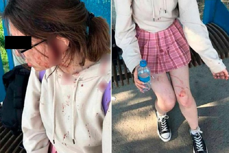 Жительницы Алматинской области избили подростка 