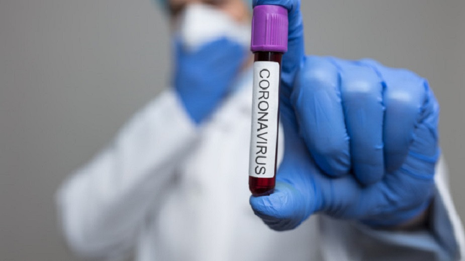 Қазақстандағы коронавирус: өткен тәулікте 1 405 адамның індет жұқтырғаны белгілі болды