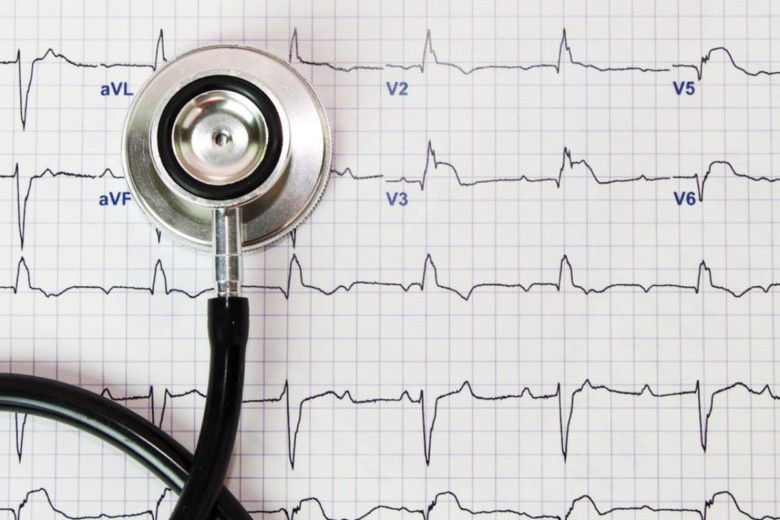 Как вовремя предотвратить инфаркт и инсульт - кардиолог