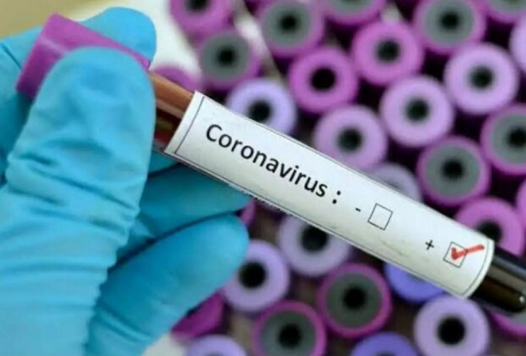 Қазақстанда өткен тәулікте тағы 5 658 адам коронавирус жұқтырды  