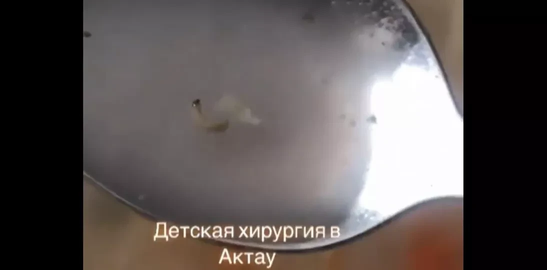Суп с червями подали пациентам больницы в Актау