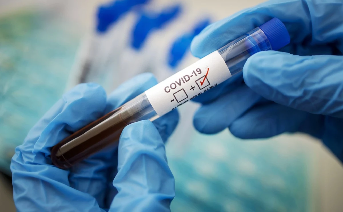 Двенадцать заболевших коронавирусом выявили за сутки в Казахстане