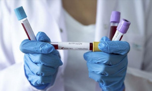 1128 заболевших коронавирусом выявили в Казахстане за сутки  