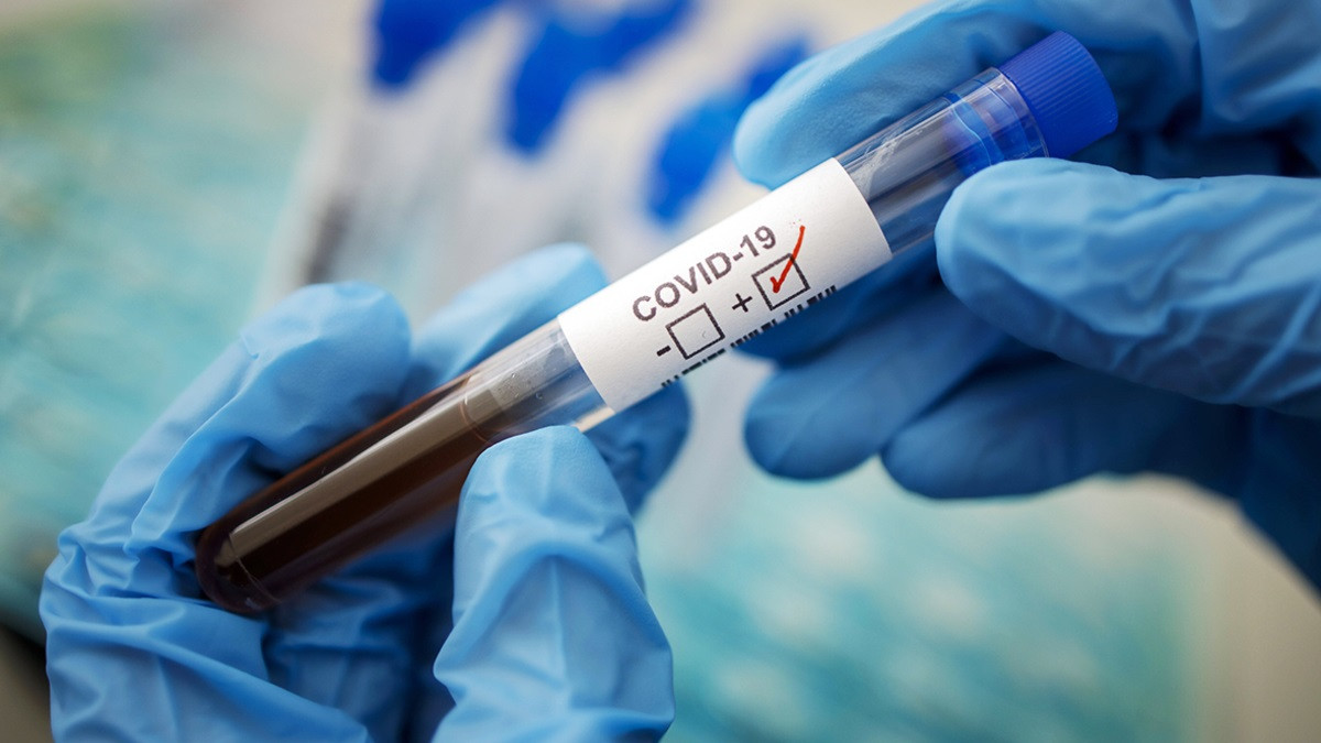 1 643 заболевших коронавирусом выявили в Казахстане за сутки