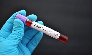 Заболеваемость коронавирусом снизилась в Казахстане