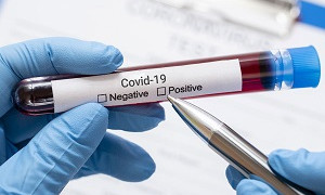 Өткен тәулікте 951 адамнан коронавирус анықталды