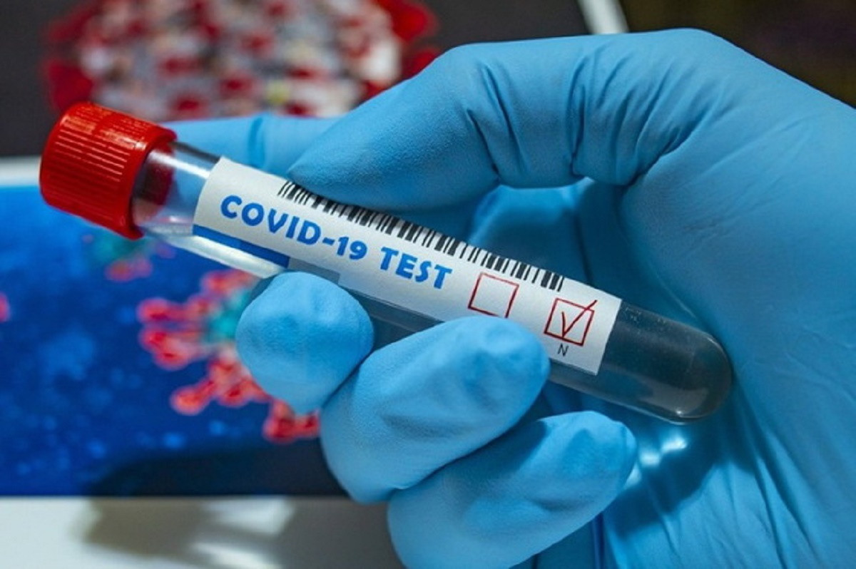Бір тәулікте 431 адамнан коронавирус анықталды