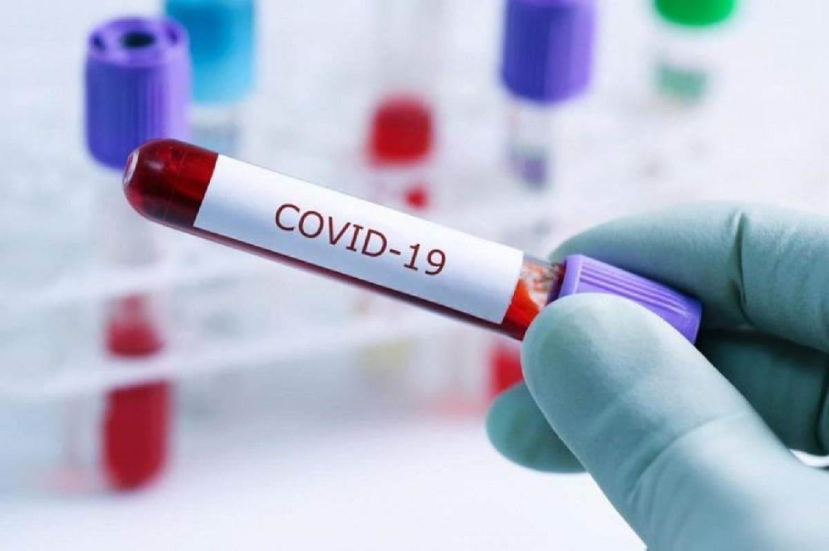 253 заболевших коронавирусом выявили в Казахстане за сутки