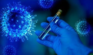 146 заболевших коронавирусом выявили в Казахстане за сутки