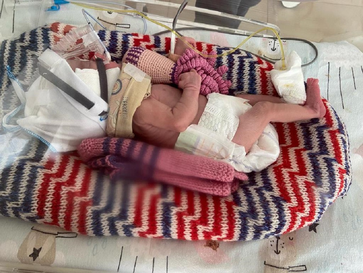 Почти четыре месяца врачи боролись за жизнь новорожденной девочки