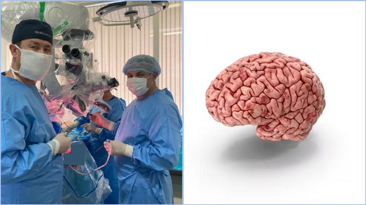 Избавили от эпилепсии: нейрохирурги провели пациенту сверхсложную операцию