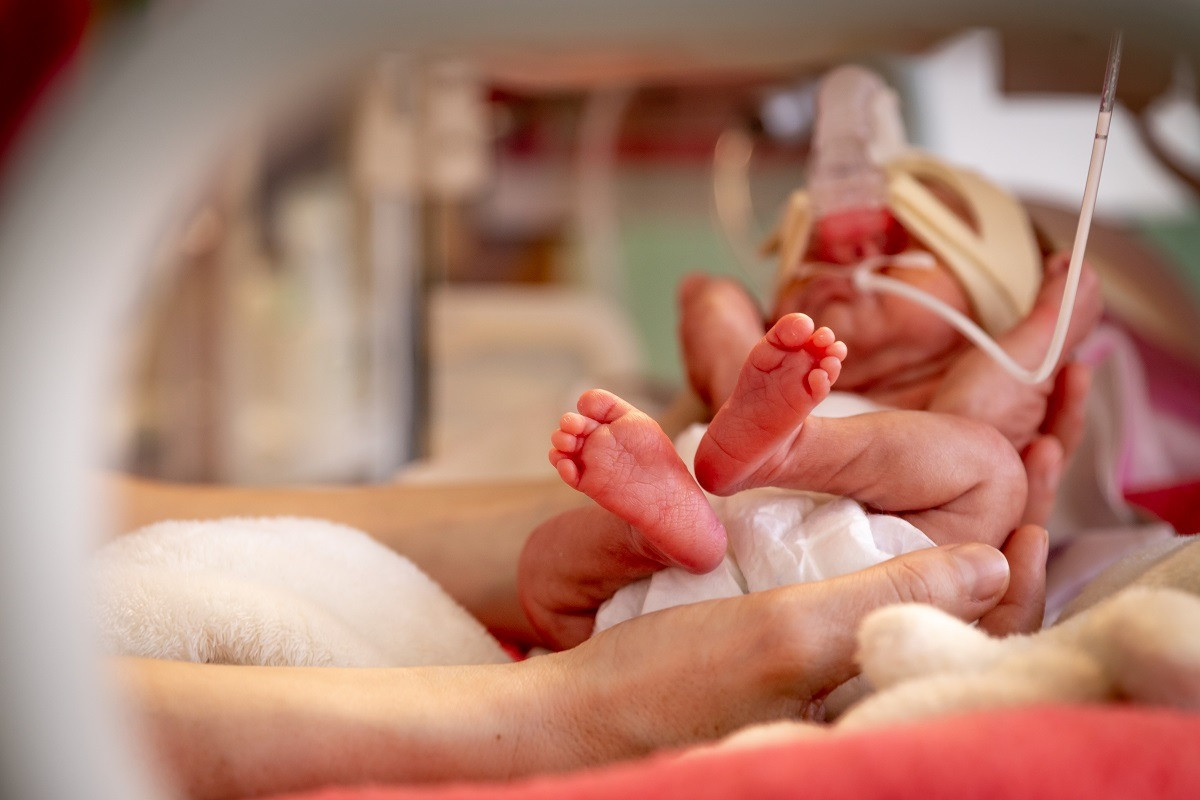 Как алматинские неонатологи выхаживают и спасают недоношенных детей