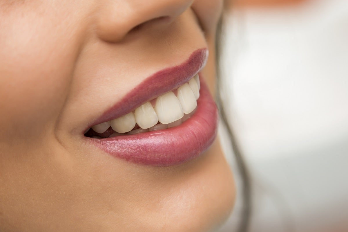 Невероятно, но факт: врачи обнаружили у женщины 38 зубов
