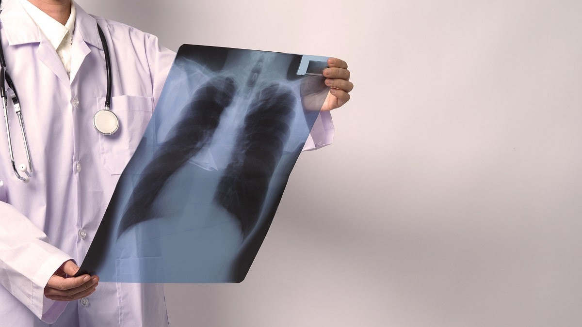 Современный тест для выявления латентной туберкулезной инфекции внедрен в Алматы