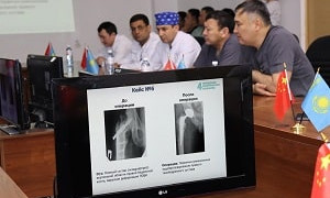 Инновации и применение ИИ в травматологии обсудили врачи Казахстана и Китая в Алматы